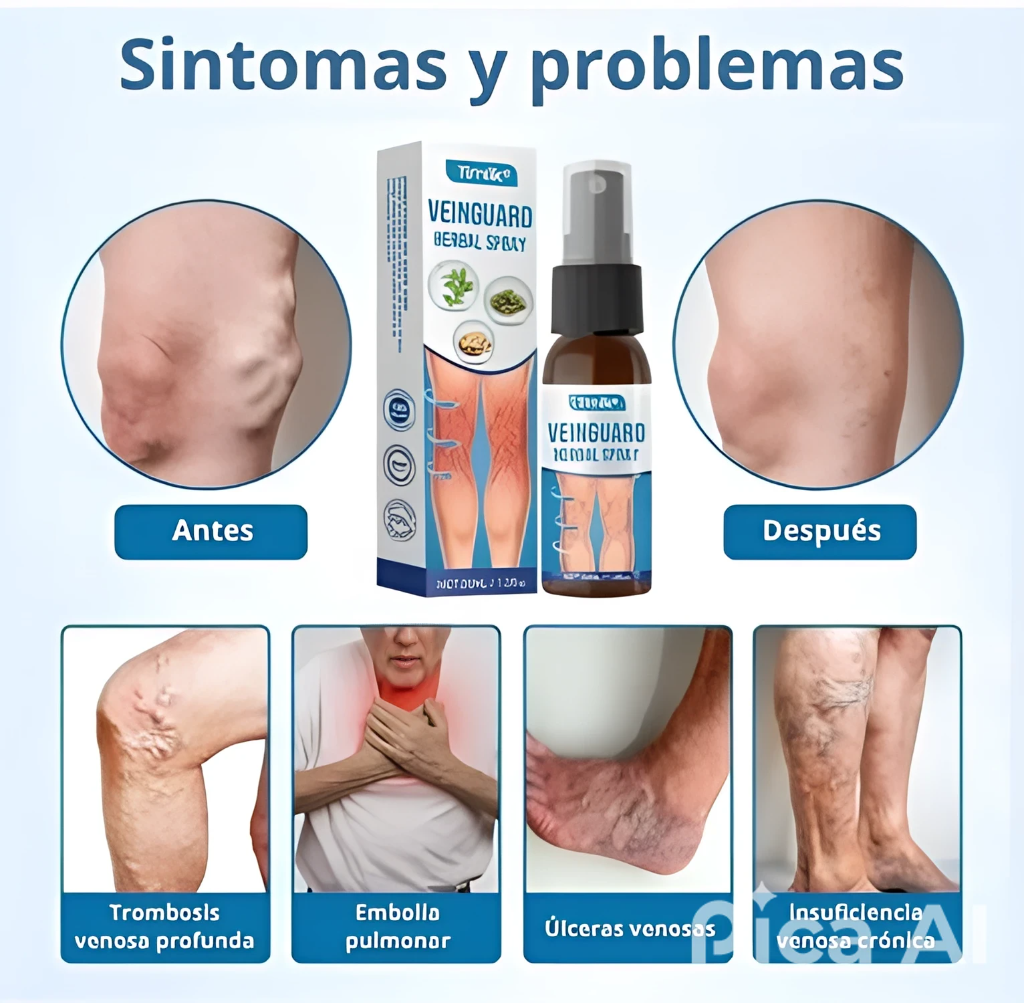 VenoClear® mas efectivo que la escleroterapia
